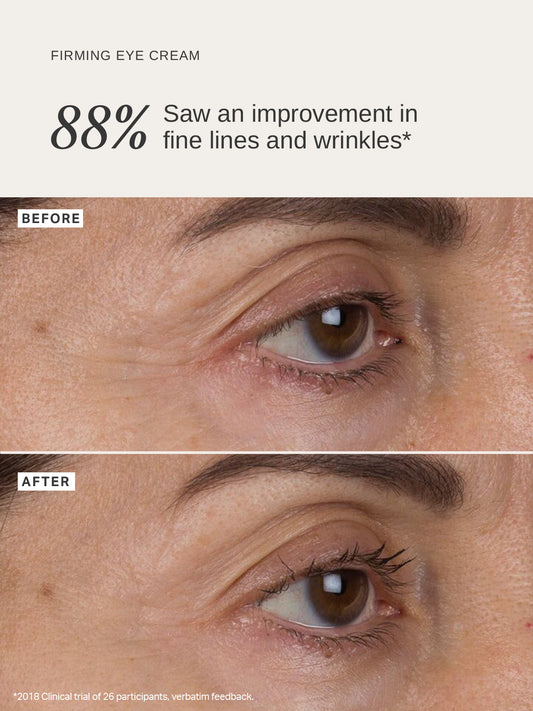 Alpha-H Liquid Gold Firming Eye Cream 15ml – peptide-rich eye treatment to firm, brighten and reduce fine lines and puffiness around the eyes