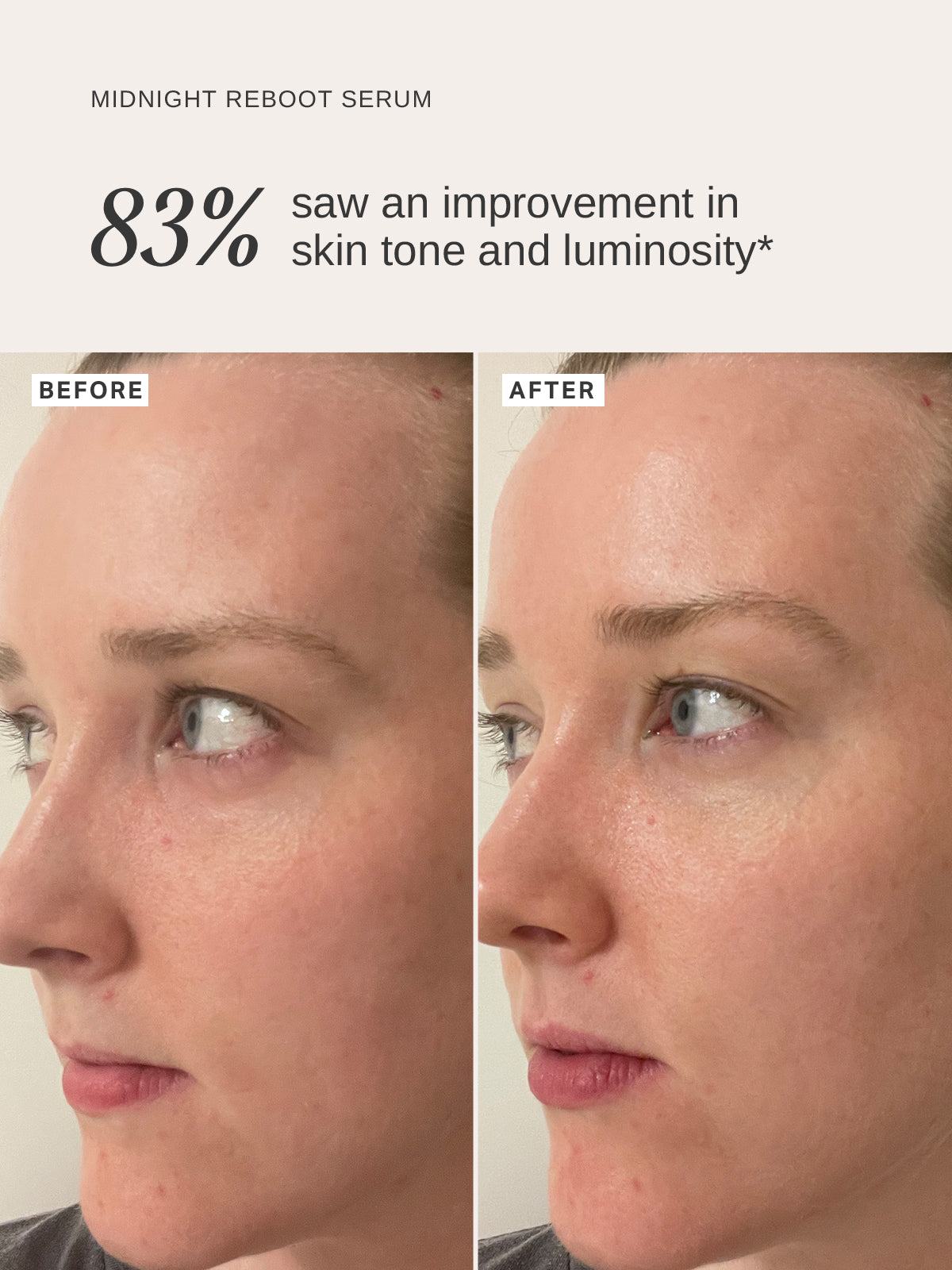Revitalize your skin with Alpha-H Liquid Gold Midnight Reboot Serum! This powerful serum, enriched with
14% Glycolic Acid and 1% Granactive Retinoid in a patent-pending formula, is proven to improve uneven tone and skin firmness, while reducing the look of fine lines and wrinkles.