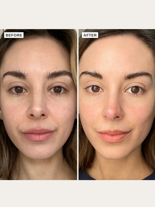 The Alpha-H Vitamin C Serum with 10% Ethyl Ascorbic Acid is a hydrating daily serum packed with gentle, but powerful new generation Vitamin C to boost brightness, even tone and give your complexion a healthy glow.
Enriched with 10% Ethyl ascorbic acid, Hyaluronic acid, Grape seed extract and Liquorice root extract, this serum is the brightening natural glow your skin needs. Say hello to a beautiful even skin tone that sings HEALTH in no time.