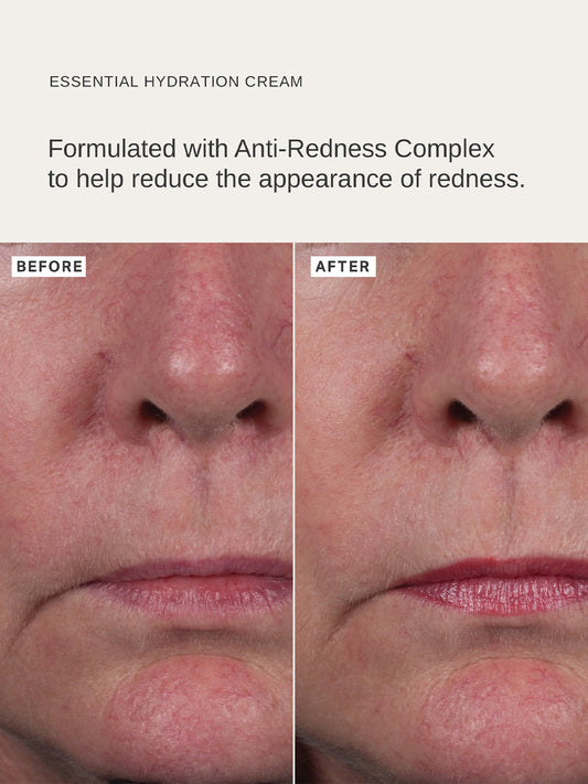 A nourishing velvet cream moisturiser that deeply hydrates and soothes the skin, the Alpha-H Essential Hydration Cream reduces the appearance of redness and is infused with a tranquil Ylang Ylang + Peppermint aroma.