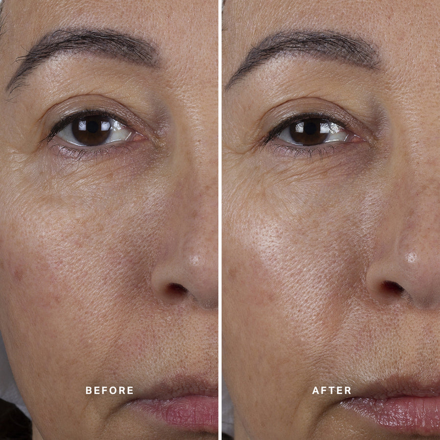 Revitalize your skin with Alpha-H Liquid Gold Midnight Reboot Serum! This powerful serum, enriched with
14% Glycolic Acid and 1% Granactive Retinoid in a patent-pending formula, is proven to improve uneven tone and skin firmness, while reducing the look of fine lines and wrinkles.