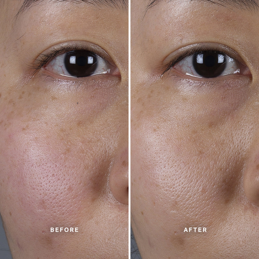 Revitalize your skin with Alpha-H Liquid Gold Midnight Reboot Serum! This powerful serum, enriched with
14% Glycolic Acid and 1% Granactive Retinoid in a patent-pending formula, is proven to improve uneven tone and skin firmness, while reducing the look of fine lines and wrinkles.