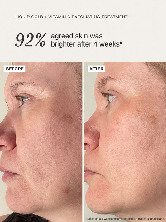 Introducing Alpha-H Liquid Gold + Vitamin C, the ultimate skincare duo for radiant, youthful skin! Combining the power of Alpha-H liquid gold with the brightening effects of vitamin c, this 100ml bottle will leave your skin glowing and rejuvenated. Say goodbye to dullness and hello to a radiant complexion!