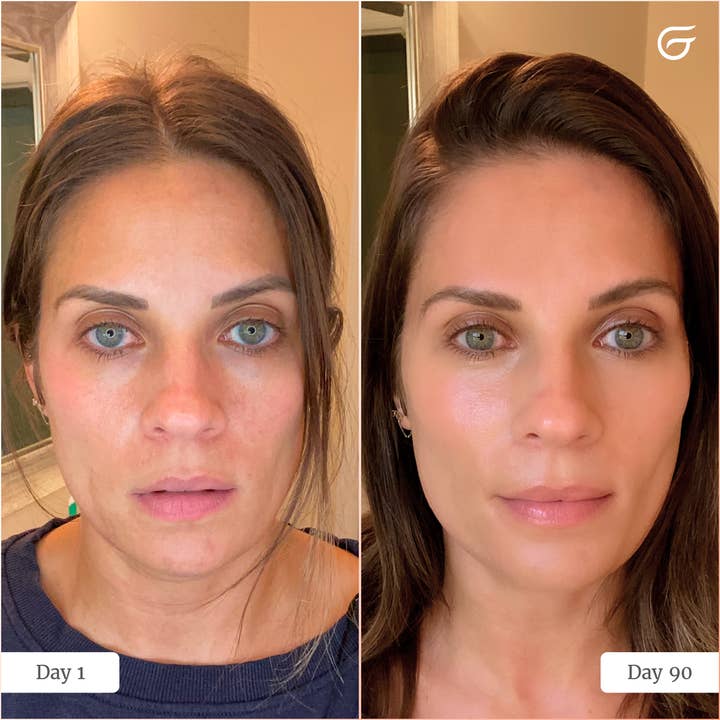 Groomie Her LED Face Mask