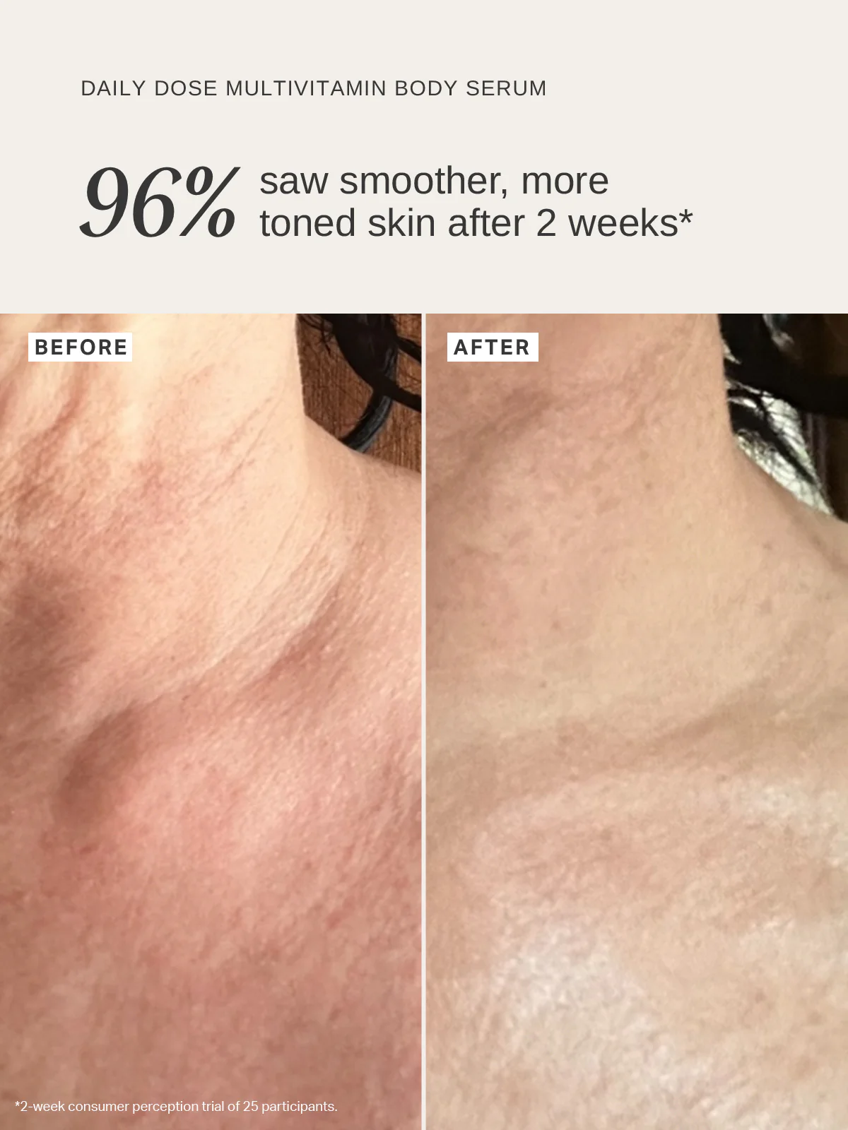 LIMITED EDITION Alpha-H Daily Dose Multivitamin Glow Body Serum 100ml